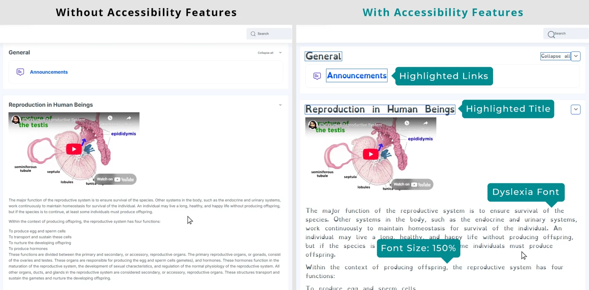 1 1 1 Moodle Accessibility Features: Highlighted Links, Highlighted Title, Dyslexia Font, Font Size